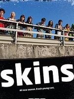imagen de Skins