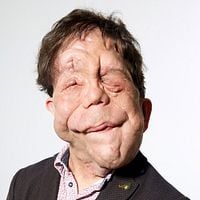 Foto Adam Pearson