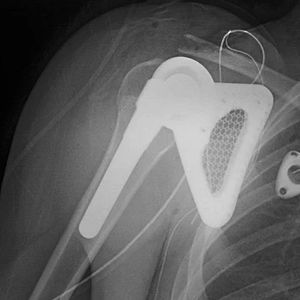 Foto Ali Eats America