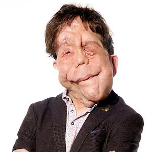 Foto Adam Pearson