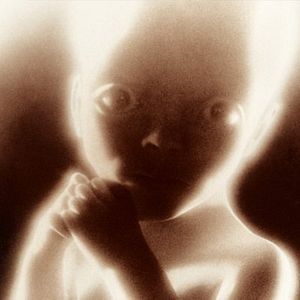 Foto 2001: Una odisea del espacio