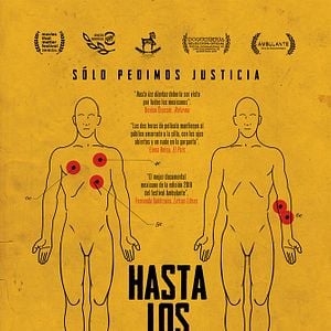 Foto Hasta los dientes