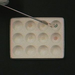 Foto Los problemas de la química