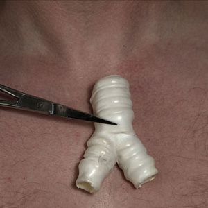 Foto El gran cirujano del engaño