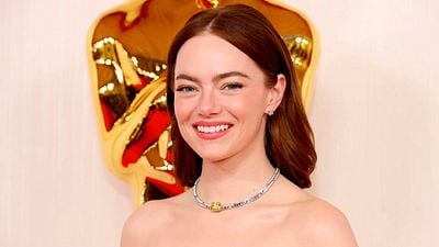 Emma Stone reaparece y divide a los fans con polémica foto: recibe críticas por supuestos procedimientos estéticos noticias imagen