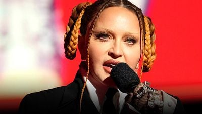 10 famosos con polémicas cirugías estéticas (Madonna no es la única) noticias imagen