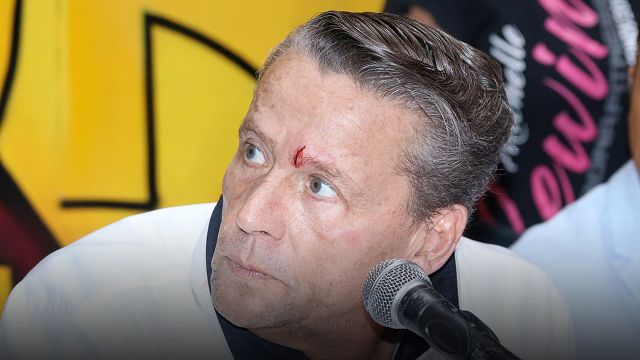"Tengo desprendimiento de retina": Alfredo Adame fue golpeado afuera de su casa noticias imagen
