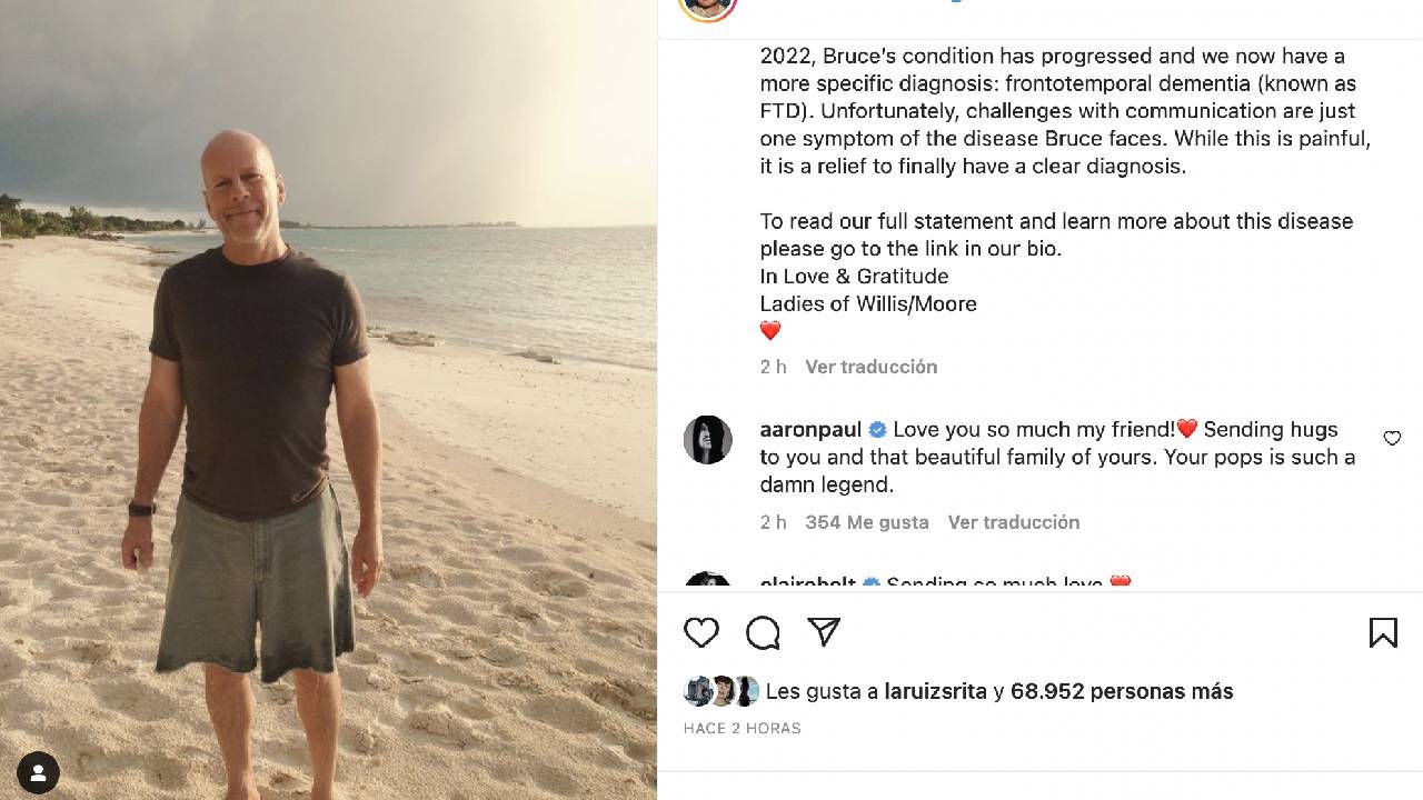 Bruce tiene demencia