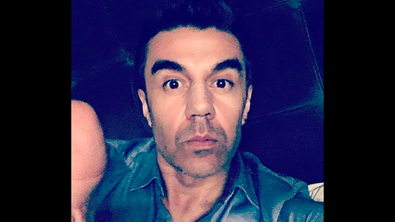 Adrián Uribe compartió los resultados de su cirugía en Instagram.